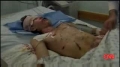 On Israel-s use of white phosphorus in Gaza - CNN - Jan 12 - English